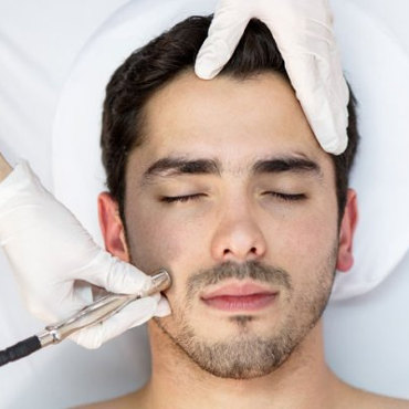 Tratament microdermabraziune